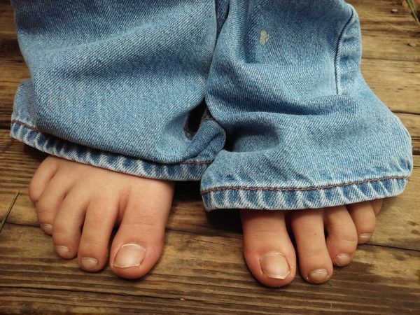 Comment soigner les mycoses des ongles